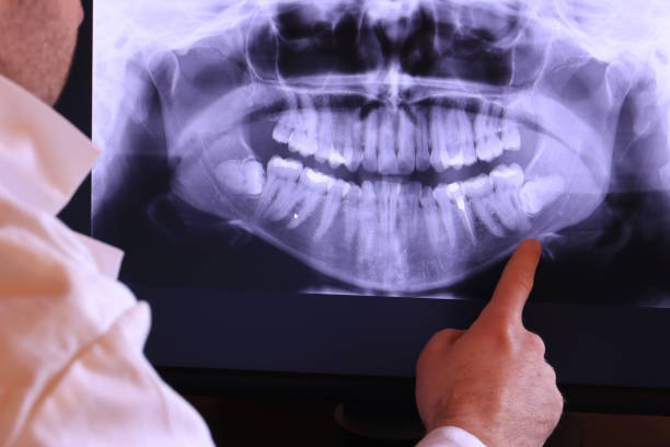 Best Weekend Emergency Dentist in Greenvle, IL