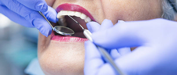 Best Emergency Dentist for Knocked-Out Tooth in Greenvle, IL